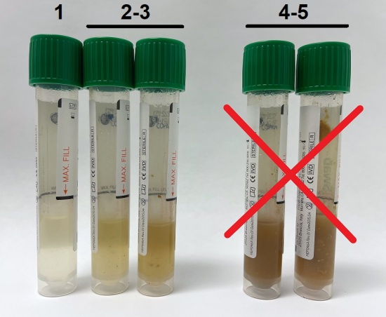 Fecalswab