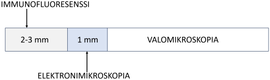 Munuaisbiopsia